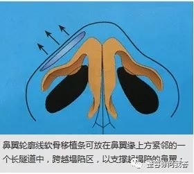 https://img.miyanlife.com/mnt/timg/180726/120IG3b-8.jpg