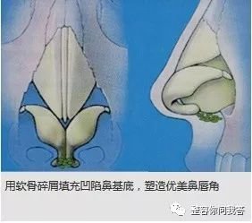 https://img.miyanlife.com/mnt/timg/180726/120IJ954-10.jpg