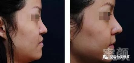 https://img.miyanlife.com/mnt/timg/180726/120IK321-11.jpg