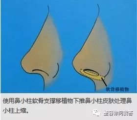 https://img.miyanlife.com/mnt/timg/180726/120IL322-9.jpg