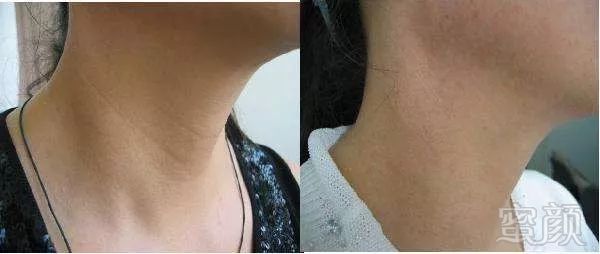 https://img.miyanlife.com/mnt/timg/180726/120U04426-6.jpg