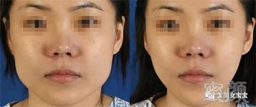 https://img.miyanlife.com/mnt/timg/180726/121449B51-0.jpg