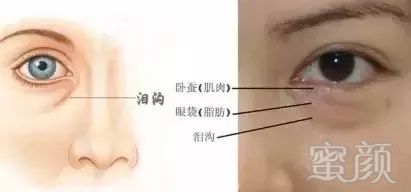 https://img.miyanlife.com/mnt/timg/180726/122G514G-2.jpg