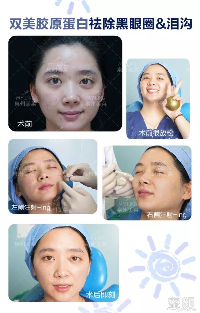 https://img.miyanlife.com/mnt/timg/180726/122GIS0-10.jpg