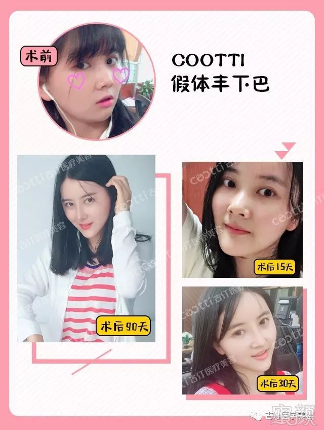 https://img.miyanlife.com/mnt/timg/180726/122S943R-6.jpg