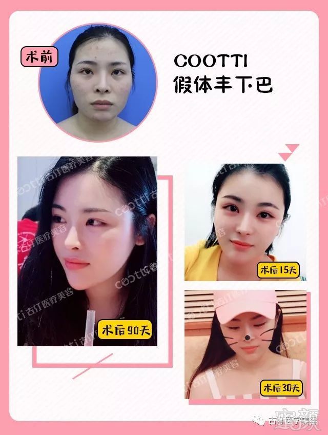 https://img.miyanlife.com/mnt/timg/180726/122T02C9-7.jpg