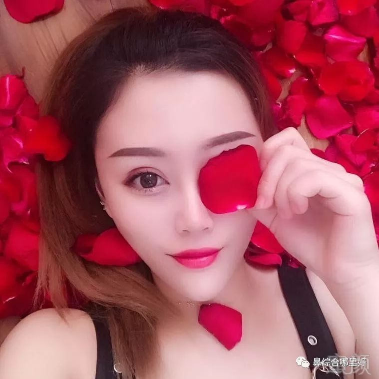 https://img.miyanlife.com/mnt/timg/180726/1232345137-5.jpg