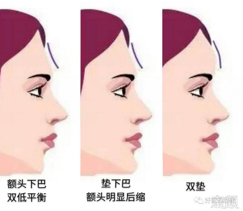 https://img.miyanlife.com/mnt/timg/180726/123450H33-8.jpg