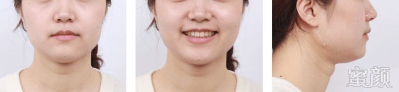 https://img.miyanlife.com/mnt/timg/180726/1300592B1-3.jpg