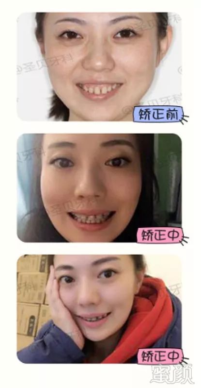 https://img.miyanlife.com/mnt/timg/180727/104F63416-4.jpg