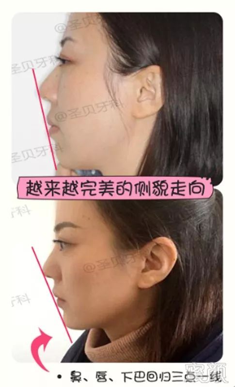 https://img.miyanlife.com/mnt/timg/180727/104FB428-5.jpg