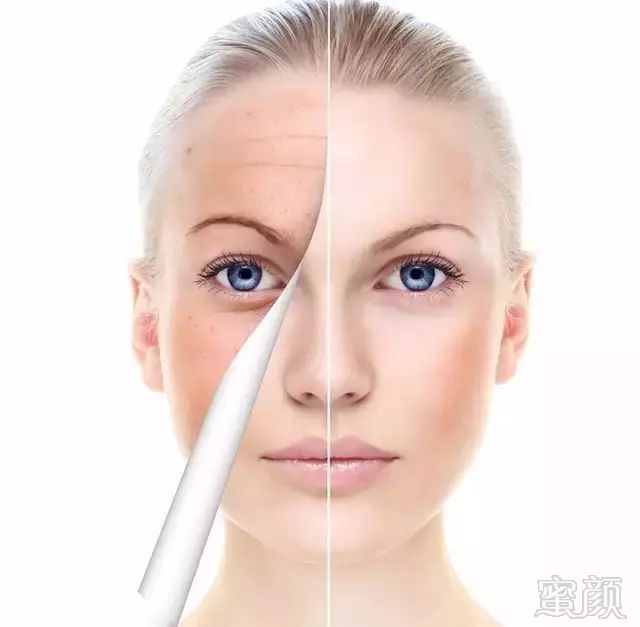 https://img.miyanlife.com/mnt/timg/180727/111A55561-4.jpg