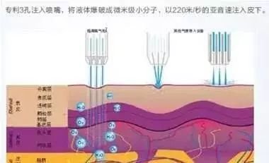 案例图片