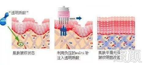 案例图片