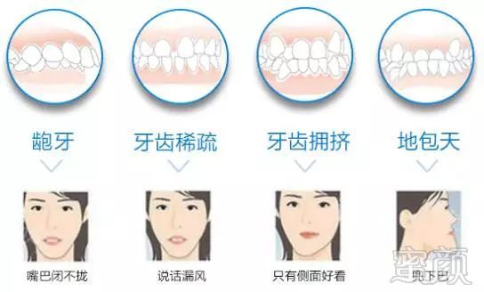 https://img.miyanlife.com/mnt/timg/180727/1131101E5-2.jpg