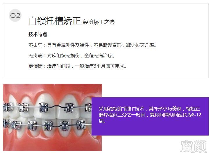 https://img.miyanlife.com/mnt/timg/180727/1131111055-6.jpg