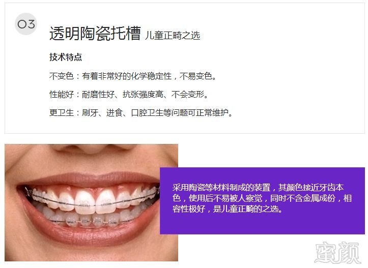 https://img.miyanlife.com/mnt/timg/180727/1131112T4-7.jpg