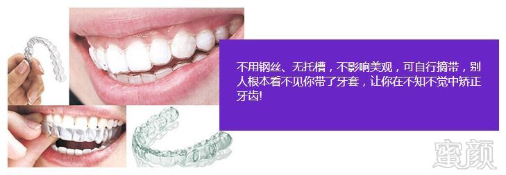 https://img.miyanlife.com/mnt/timg/180727/113111AY-5.jpg