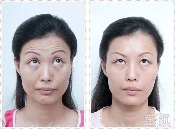 https://img.miyanlife.com/mnt/timg/180727/114F91403-12.jpg