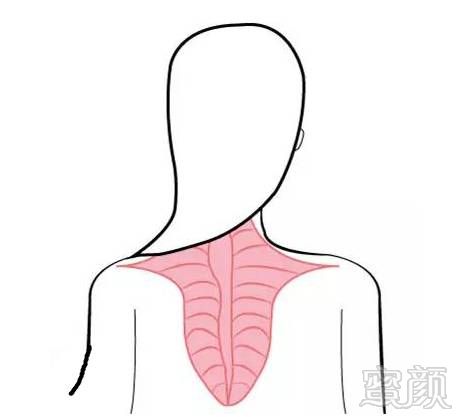 https://img.miyanlife.com/mnt/timg/180727/114F92556-5.jpg