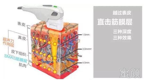 https://img.miyanlife.com/mnt/timg/180727/114I0J04-6.jpg