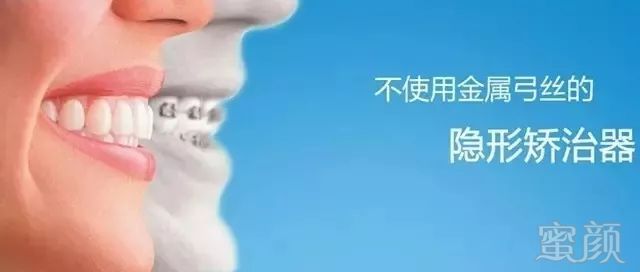 https://img.miyanlife.com/mnt/timg/180727/11534a3N-6.jpg