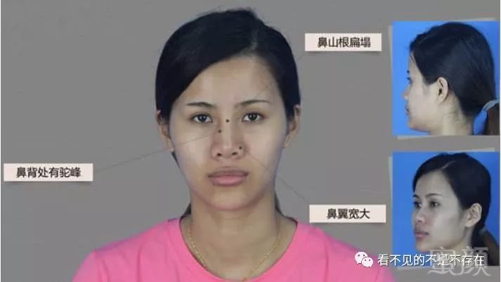 https://img.miyanlife.com/mnt/timg/180727/1154156424-7.jpg