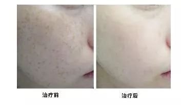 https://img.miyanlife.com/mnt/timg/180727/1154414229-4.jpg