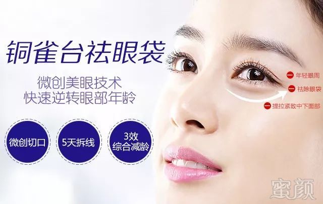 https://img.miyanlife.com/mnt/timg/180727/120U43560-4.jpg