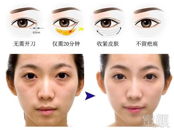 https://img.miyanlife.com/mnt/timg/180727/120U63409-12.jpg