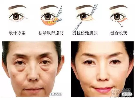 https://img.miyanlife.com/mnt/timg/180727/120UJ5P-13.jpg