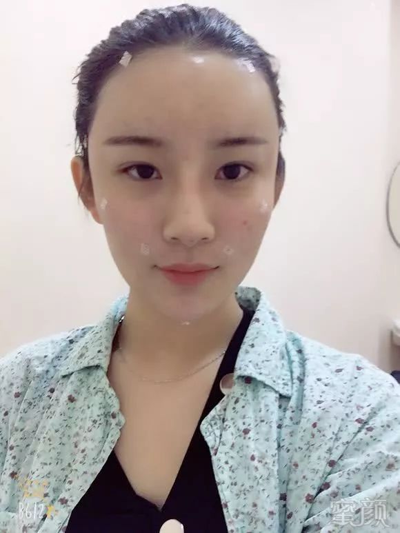 https://img.miyanlife.com/mnt/timg/180727/12304B460-2.jpg