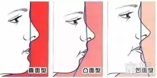https://img.miyanlife.com/mnt/timg/180728/10300032E-0.jpg