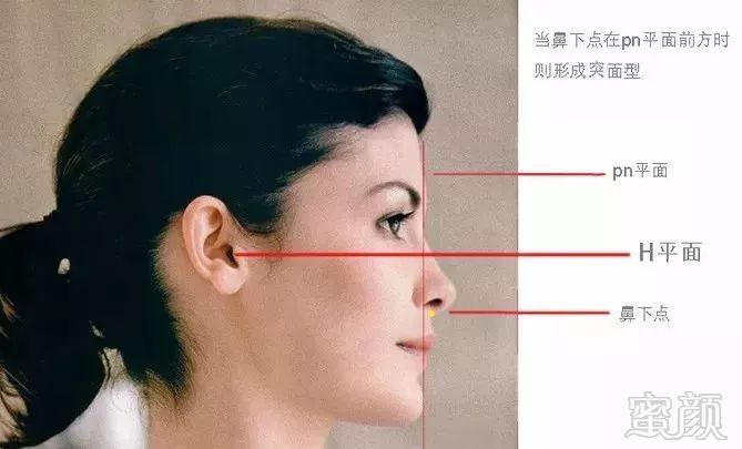 https://img.miyanlife.com/mnt/timg/180728/10300051R-1.jpg