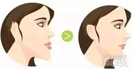 https://img.miyanlife.com/mnt/timg/180728/103000M02-2.jpg