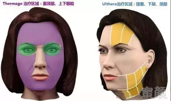 https://img.miyanlife.com/mnt/timg/180728/10523634H-2.jpg