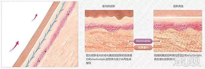 https://img.miyanlife.com/mnt/timg/180728/10523Ib4-6.jpg