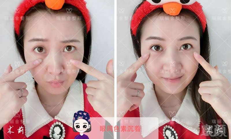 https://img.miyanlife.com/mnt/timg/180728/10532GZ3-8.jpg