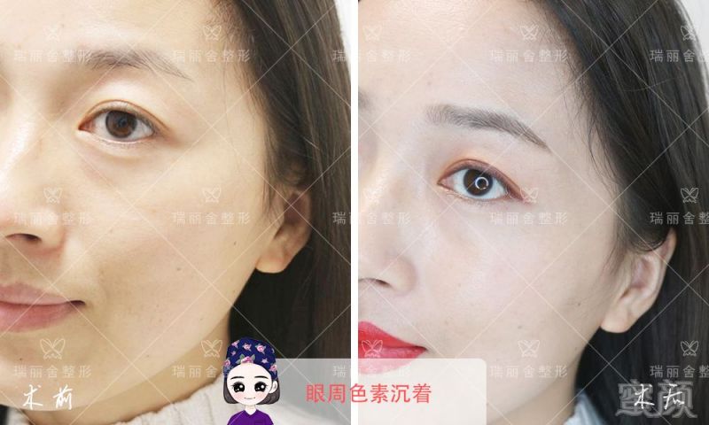 https://img.miyanlife.com/mnt/timg/180728/10532UY7-9.jpg