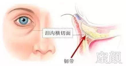 https://img.miyanlife.com/mnt/timg/180728/1055164092-3.jpg