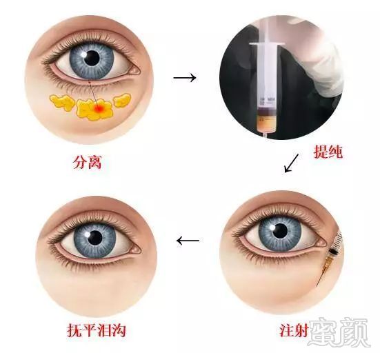 https://img.miyanlife.com/mnt/timg/180728/1055251628-9.jpg