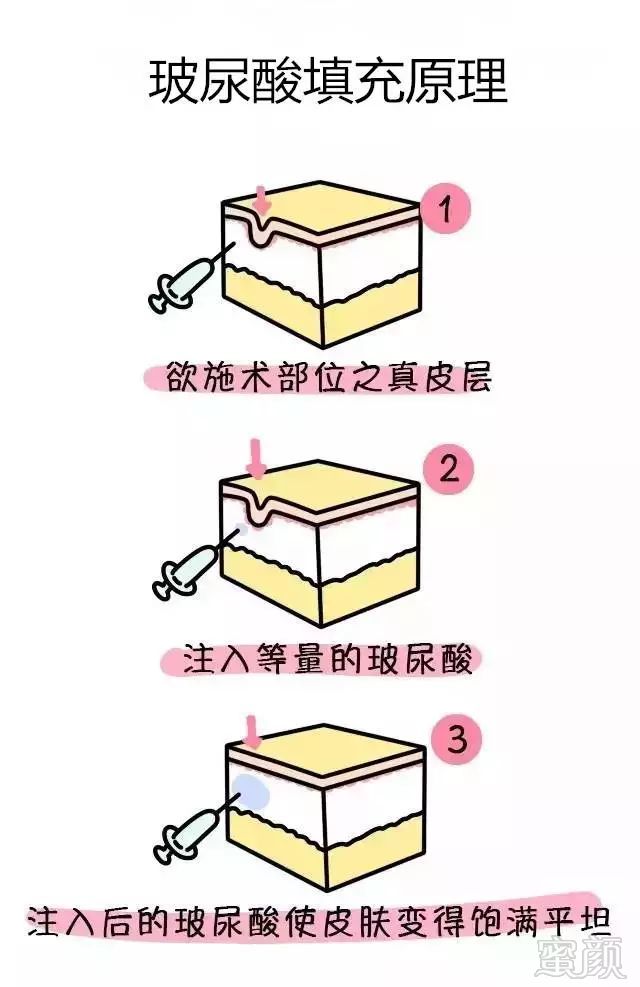 https://img.miyanlife.com/mnt/timg/180728/1055253958-7.jpg