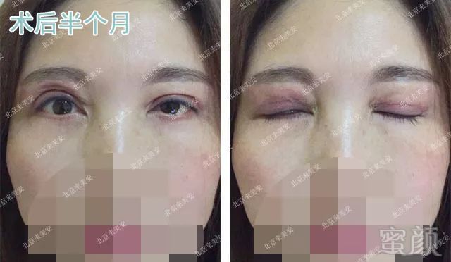 https://img.miyanlife.com/mnt/timg/180728/1100561160-3.jpg