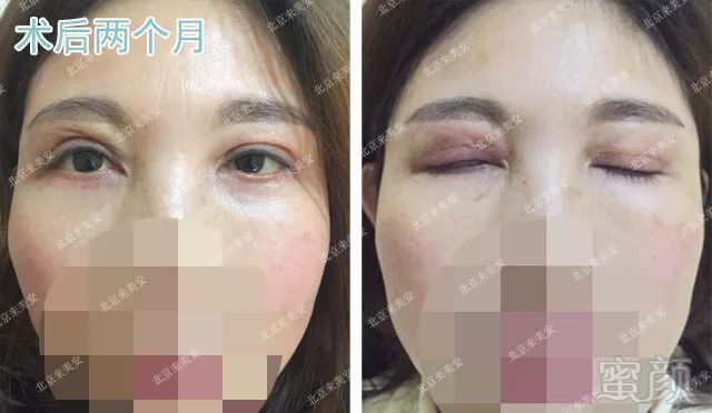 https://img.miyanlife.com/mnt/timg/180728/1100564929-4.jpg