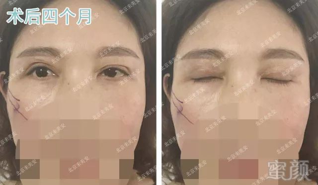 https://img.miyanlife.com/mnt/timg/180728/11005H641-5.jpg