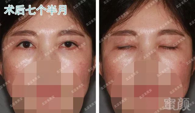 https://img.miyanlife.com/mnt/timg/180728/11005M5H-6.jpg