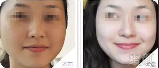 https://img.miyanlife.com/mnt/timg/180728/11093B946-1.jpg