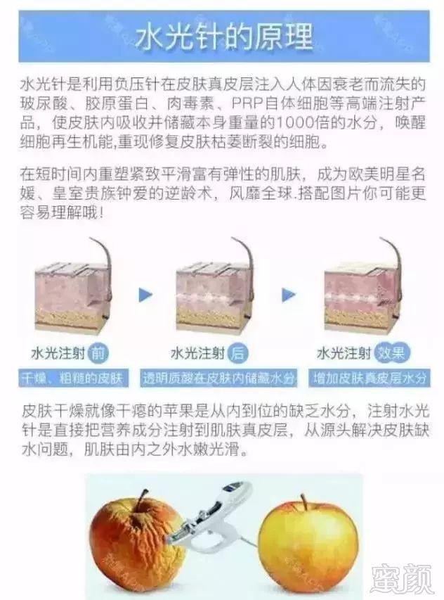 https://img.miyanlife.com/mnt/timg/180728/11094163D-4.jpg