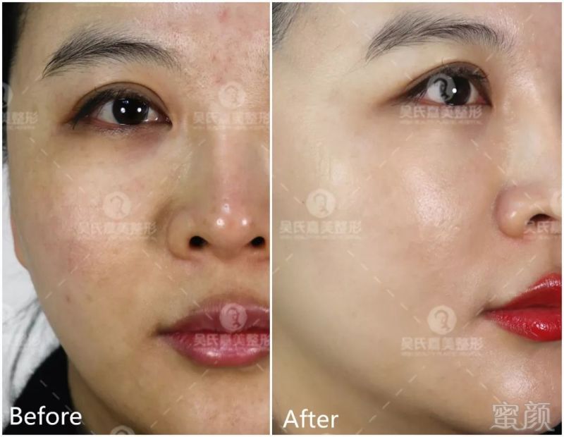 https://img.miyanlife.com/mnt/timg/180728/11094H449-6.jpg