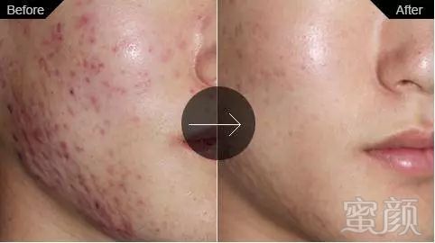 https://img.miyanlife.com/mnt/timg/180728/111034D00-9.jpg